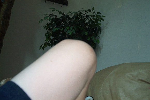 IM000656